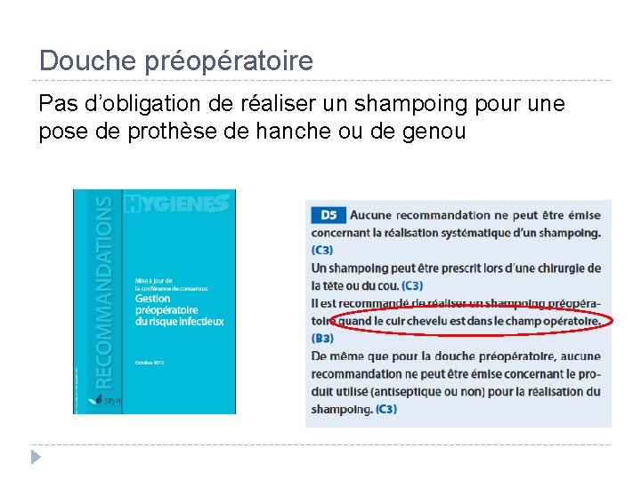 Douche préopératoire Pas d’obligation de réaliser un shampoing pour une pose de prothèse de