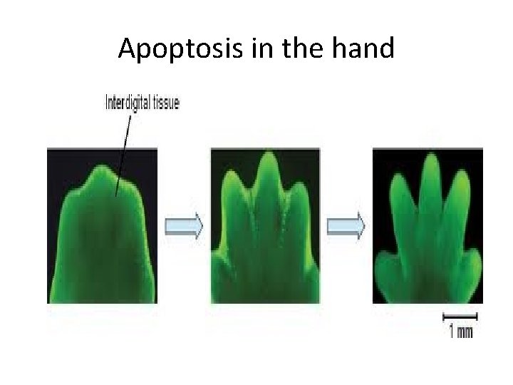 Apoptosis in the hand 