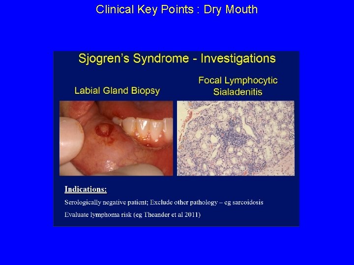 Clinical Key Points : Dry Mouth 