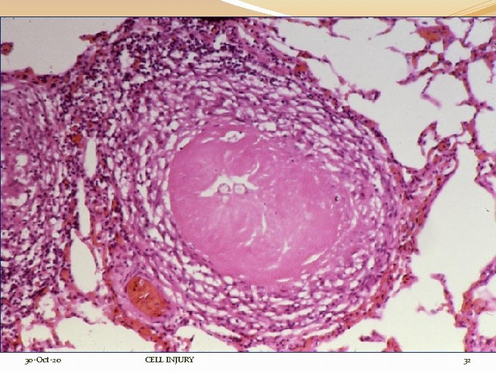 30 -Oct-20 CELL INJURY 32 