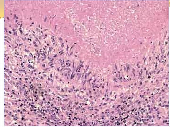 30 -Oct-20 CELL INJURY 33 