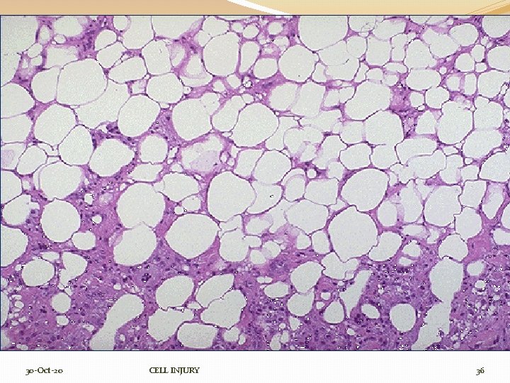 30 -Oct-20 CELL INJURY 36 