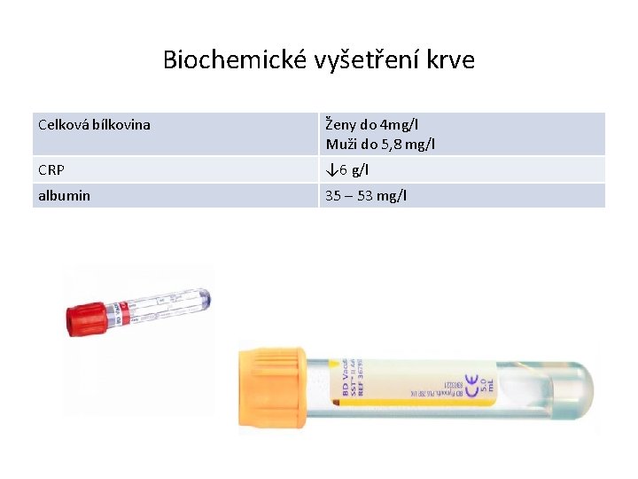 Biochemické vyšetření krve Celková bílkovina Ženy do 4 mg/l Muži do 5, 8 mg/l