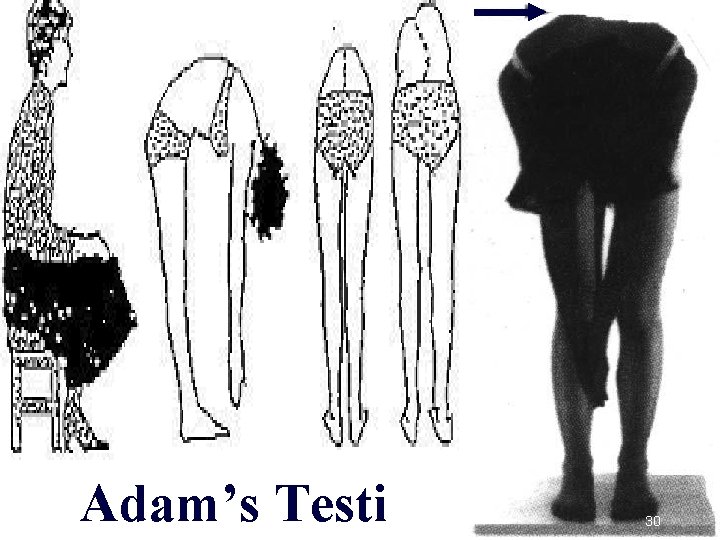 Adam’s Testi 30 