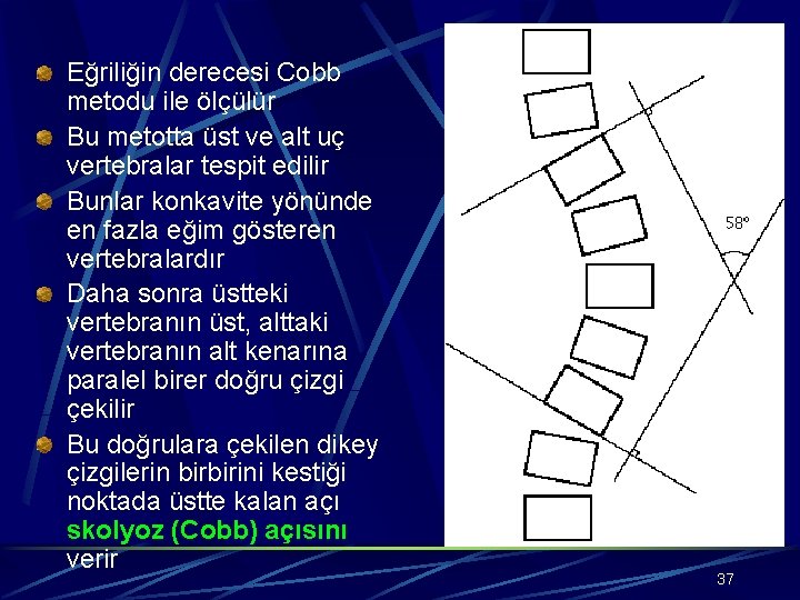 Eğriliğin derecesi Cobb metodu ile ölçülür Bu metotta üst ve alt uç vertebralar tespit