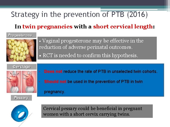 Strategy in the prevention of PTB (2016) In twin pregnancies with a short cervical