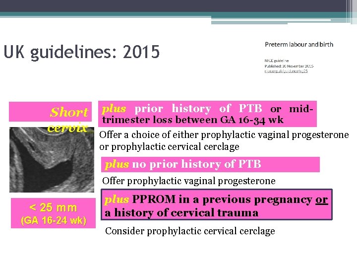 UK guidelines: 2015 Short cervix plus prior history of PTB or midtrimester loss between