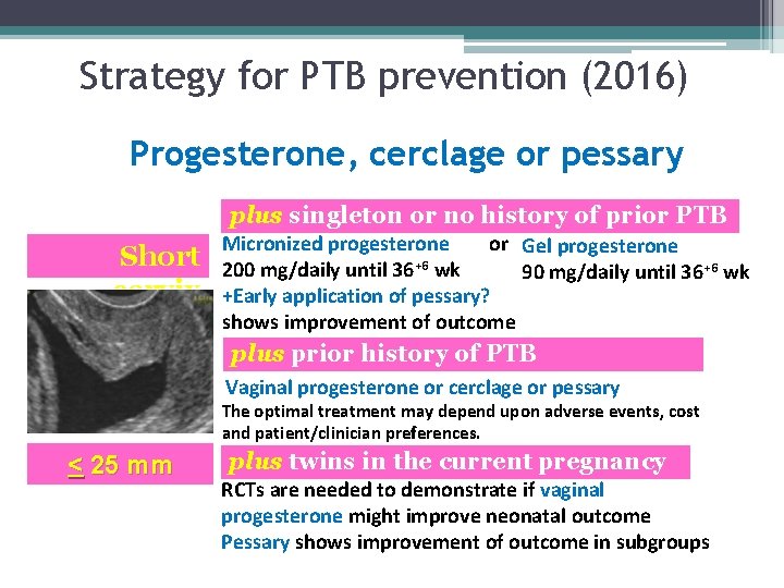 Strategy for PTB prevention (2016) Progesterone, cerclage or pessary plus singleton or no history