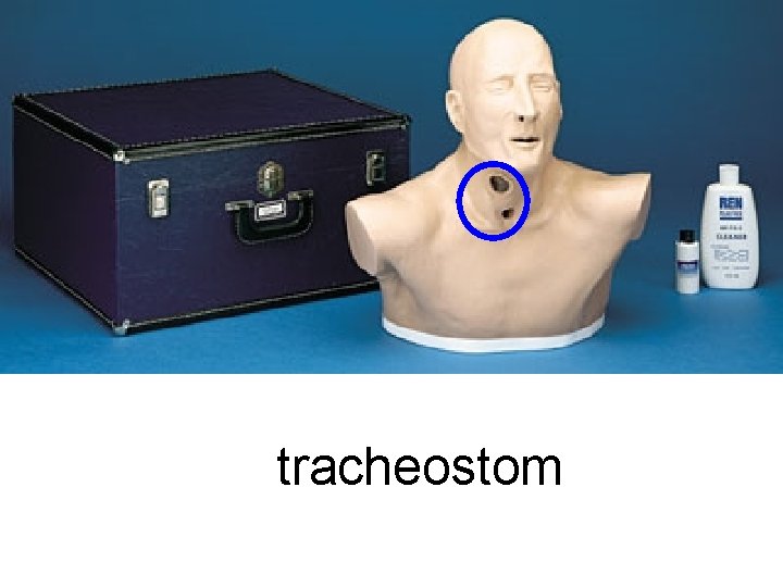 tracheostom 