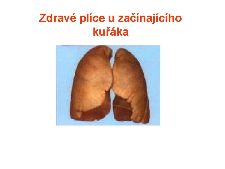 Zdravé plíce u začínajícího kuřáka 