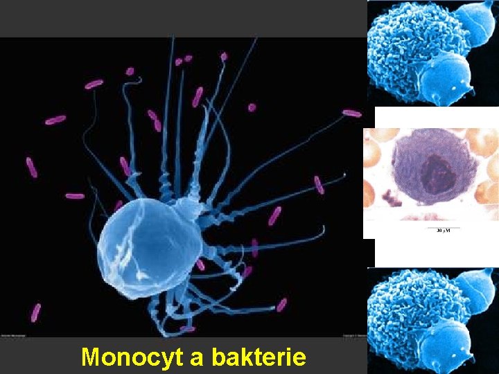 Monocyt a bakterie 