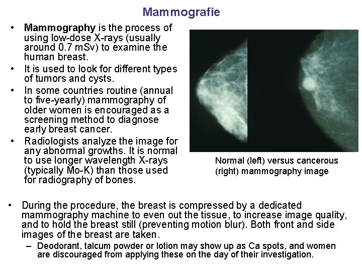 Mammografie • Mammography is the process of using low-dose X-rays (usually around 0. 7