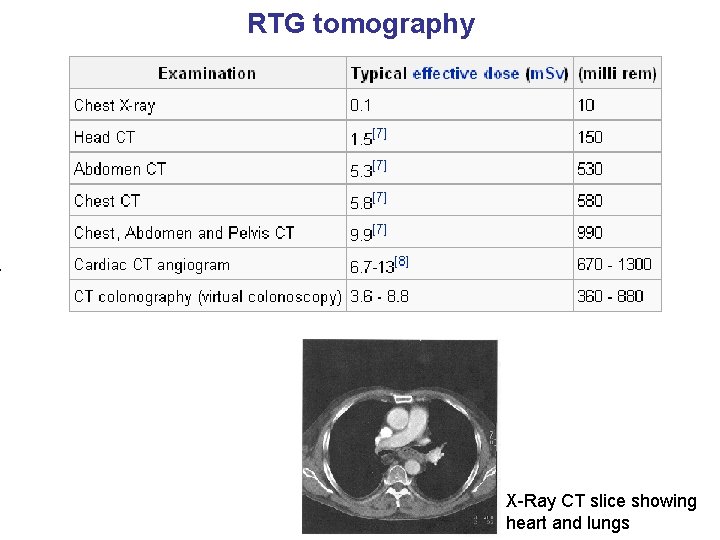 RTG tomography X-Ray CT slice showing heart and lungs 
