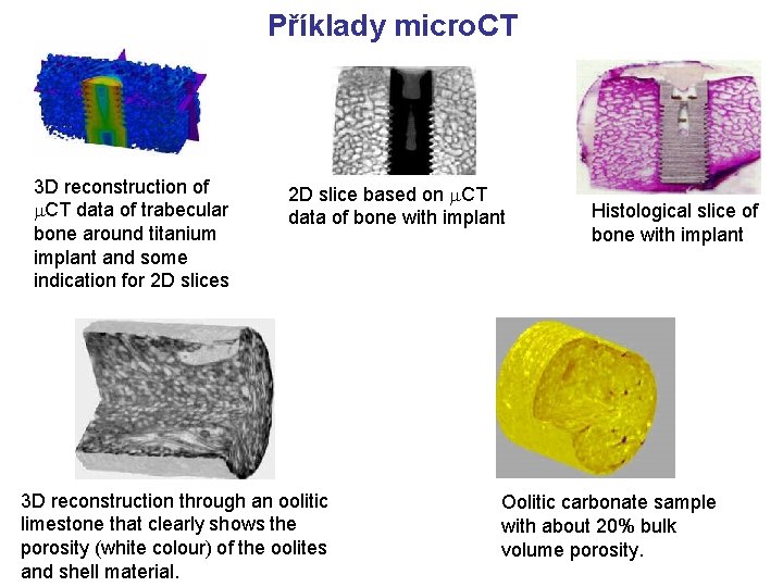 Příklady micro. CT 3 D reconstruction of m. CT data of trabecular bone around