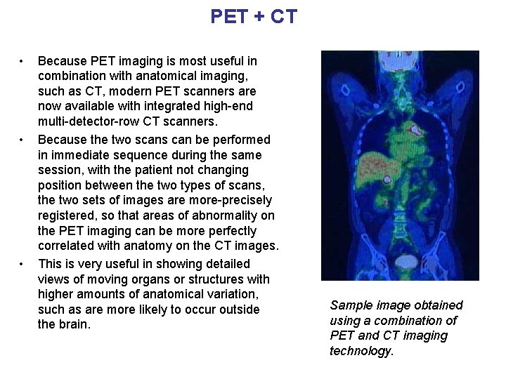 PET + CT • • • Because PET imaging is most useful in combination