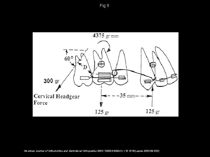 Fig 9 American Journal of Orthodontics and Dentofacial Orthopedics 2004 125624 -629 DOI: (10.