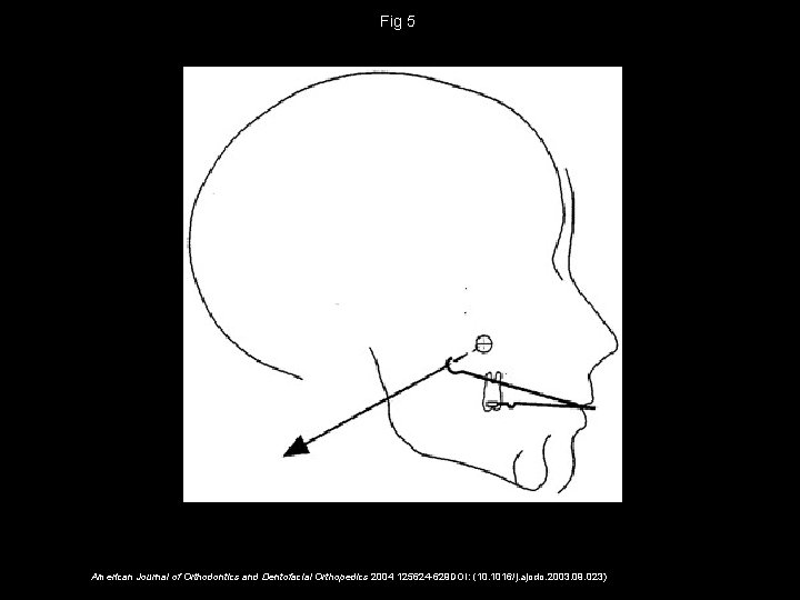 Fig 5 American Journal of Orthodontics and Dentofacial Orthopedics 2004 125624 -629 DOI: (10.