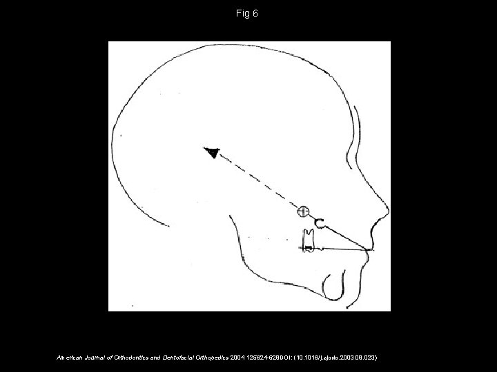 Fig 6 American Journal of Orthodontics and Dentofacial Orthopedics 2004 125624 -629 DOI: (10.