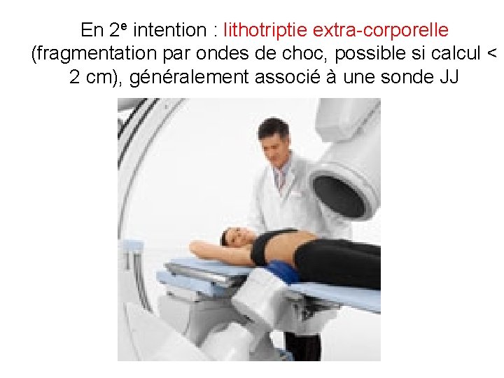 En 2 e intention : lithotriptie extra-corporelle (fragmentation par ondes de choc, possible si En 2 e intention : lithotriptie extra-corporelle (fragmentation par ondes de choc, possible si