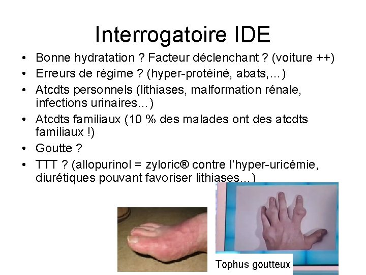 Interrogatoire IDE • Bonne hydratation ? Facteur déclenchant ? (voiture ++) • Erreurs de Interrogatoire IDE • Bonne hydratation ? Facteur déclenchant ? (voiture ++) • Erreurs de
