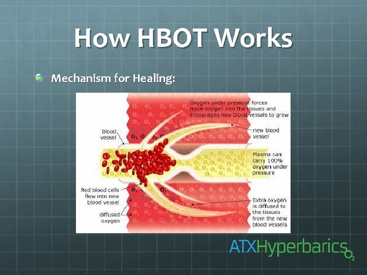 How HBOT Works Mechanism for Healing: 
