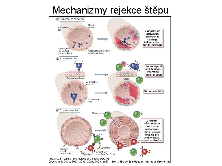 Mechanizmy rejekce štěpu 