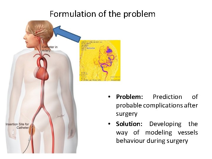 Formulation of the problem • Problem: Prediction of probable complications after surgery • Solution: