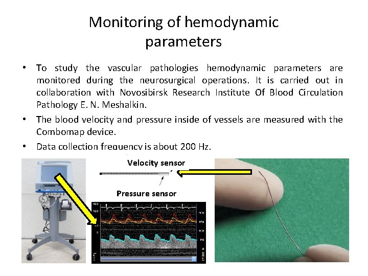 Monitoring of hemodynamic parameters • To study the vascular pathologies hemodynamic parameters are monitored