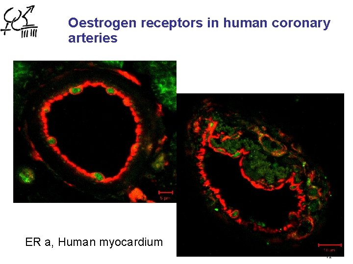 Oestrogen receptors in human coronary arteries ER a, Human myocardium 41 