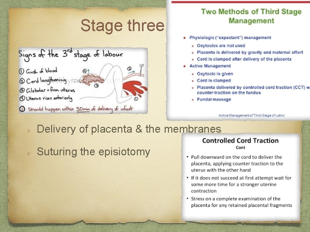 Stage three Delivery of placenta & the membranes Suturing the episiotomy 