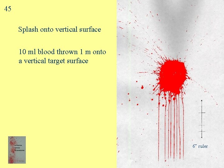 45 Splash onto vertical surface 10 ml blood thrown 1 m onto a vertical