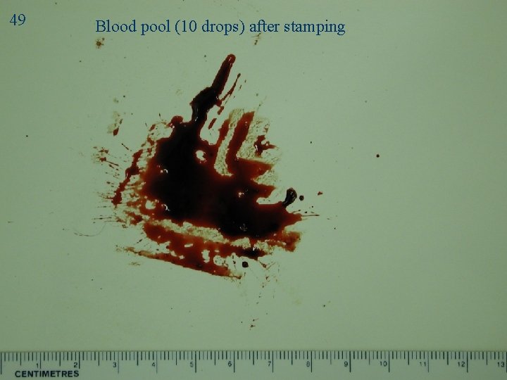 49 Blood pool (10 drops) after stamping Stamp 2 