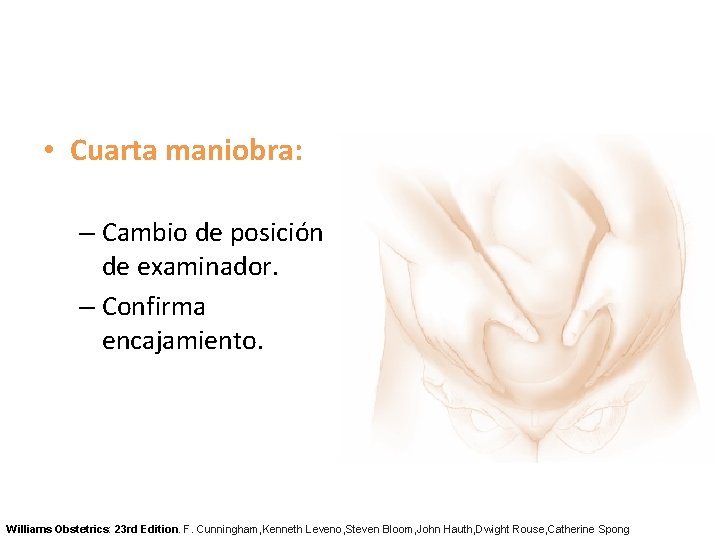  • Cuarta maniobra: – Cambio de posición de examinador. – Confirma encajamiento. Williams