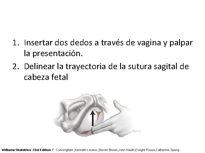 1. Insertar dos dedos a través de vagina y palpar la presentación. 2. Delinear