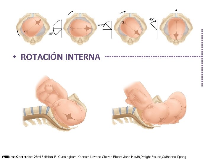  • ROTACIÓN INTERNA Williams Obstetrics: 23 rd Edition. F. Cunningham, Kenneth Leveno, Steven
