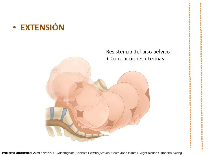  • EXTENSIÓN Resistencia del piso pélvico + Contracciones uterinas Williams Obstetrics: 23 rd