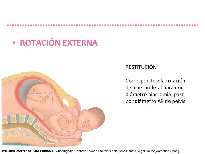  • ROTACIÓN EXTERNA RESTITUCIÓN Corresponde a la rotación del cuerpo fetal para que