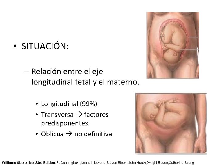  • SITUACIÓN: – Relación entre el eje longitudinal fetal y el materno. •