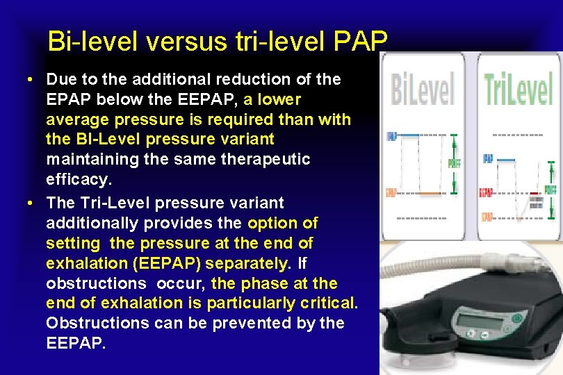 Bi-level versus tri-level PAP • Due to the additional reduction of the EPAP below