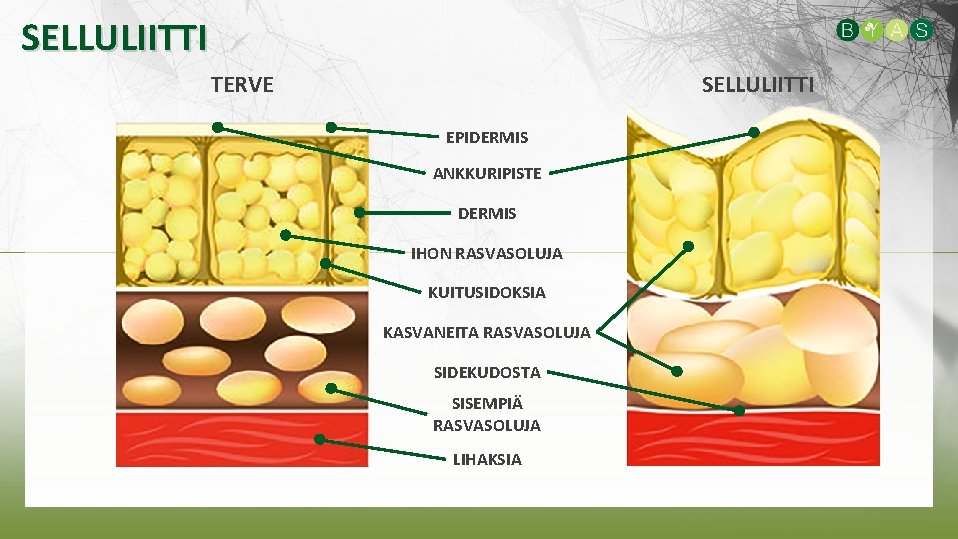 SELLULIITTI TERVE SELLULIITTI EPIDERMIS ANKKURIPISTE DERMIS IHON RASVASOLUJA KUITUSIDOKSIA KASVANEITA RASVASOLUJA SIDEKUDOSTA SISEMPIÄ RASVASOLUJA