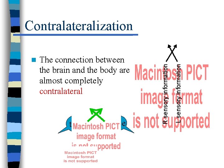 The connection between the brain and the body are almost completely contralateral two three