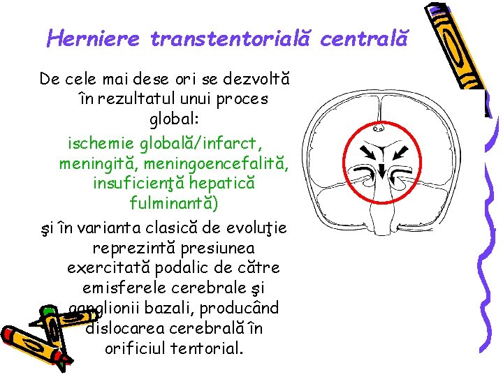 Herniere transtentorială centrală De cele mai dese ori se dezvoltă în rezultatul unui proces