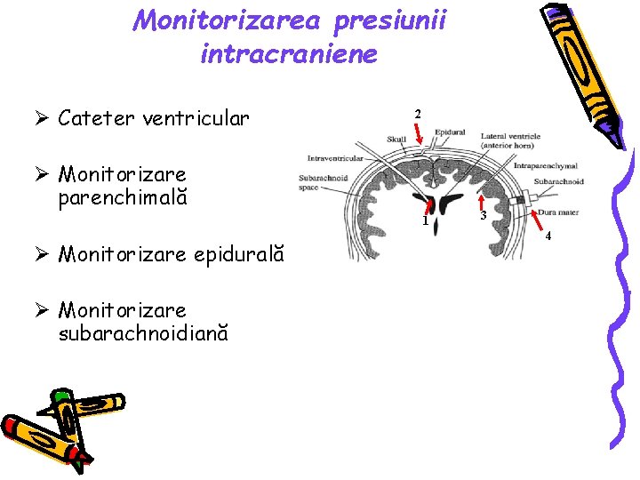 Monitorizarea presiunii intracraniene Ø Cateter ventricular 2 Ø Monitorizare parenchimală 1 Ø Monitorizare epidurală