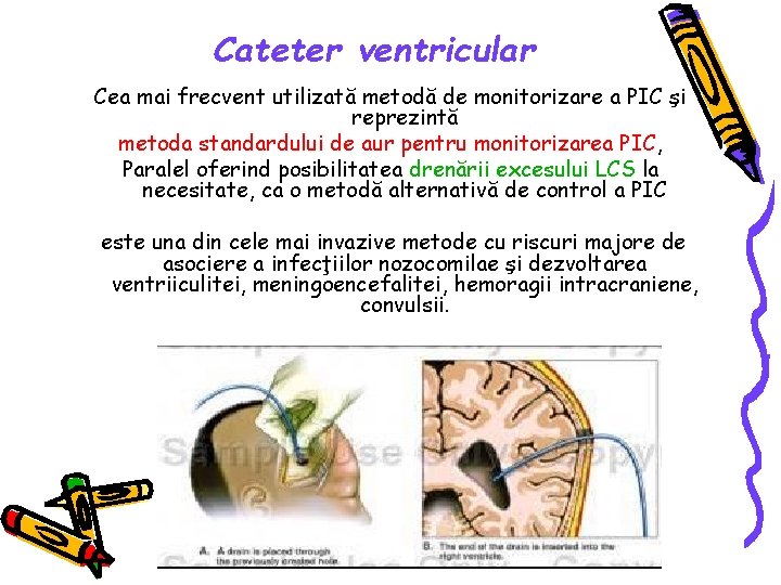Cateter ventricular Cea mai frecvent utilizată metodă de monitorizare a PIC şi reprezintă metoda