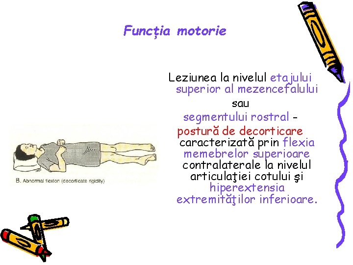 Funcţia motorie Leziunea la nivelul etajului superior al mezencefalului sau segmentului rostral postură de