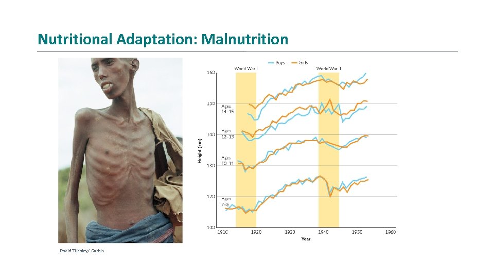 Nutritional Adaptation: Malnutrition David Turnley/ Corbis 
