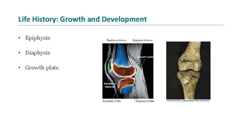 Life History: Growth and Development • Epiphysis • Diaphysis • Growth plate Gwen Robbins,
