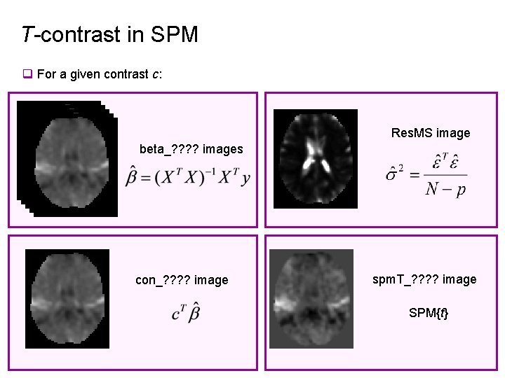 T-contrast in SPM q For a given contrast c: Res. MS image beta_? ?