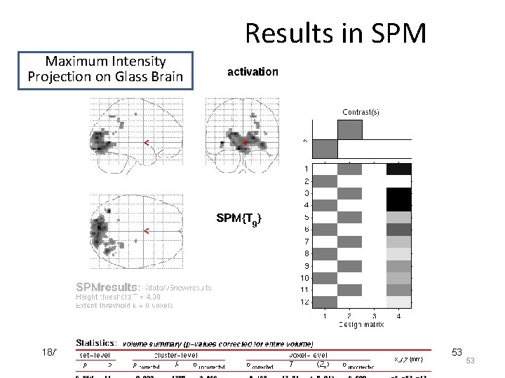 Results in SPM Maximum Intensity Projection on Glass Brain 18/11/2009 RFT for dummies -