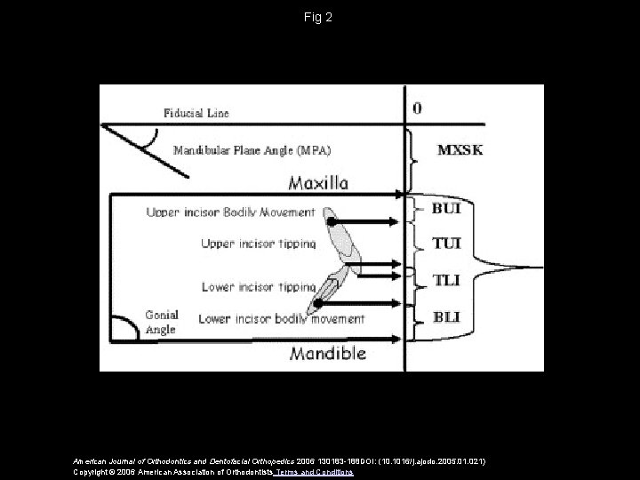 Fig 2 American Journal of Orthodontics and Dentofacial Orthopedics 2006 130183 -188 DOI: (10.